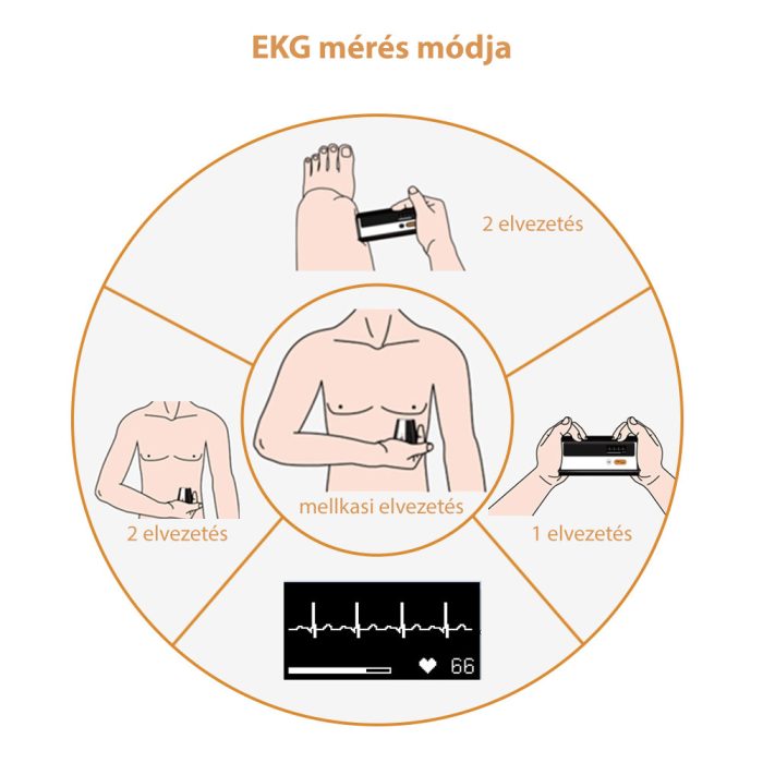 Viatom Armfit+ Vérnyomásmérő EKG funkcióval - Image 9