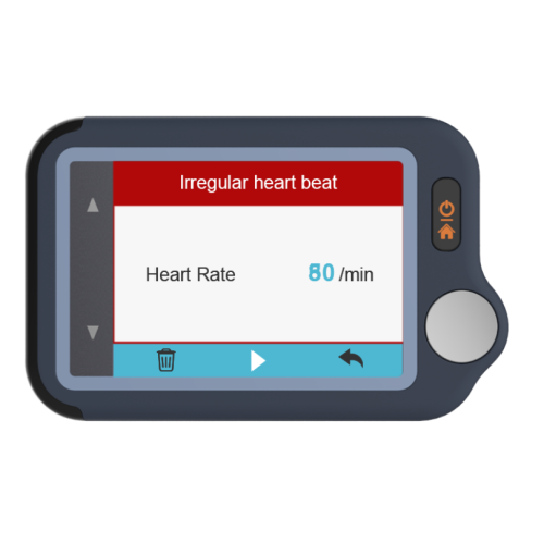 Viatom Pulsebit személyi EKG