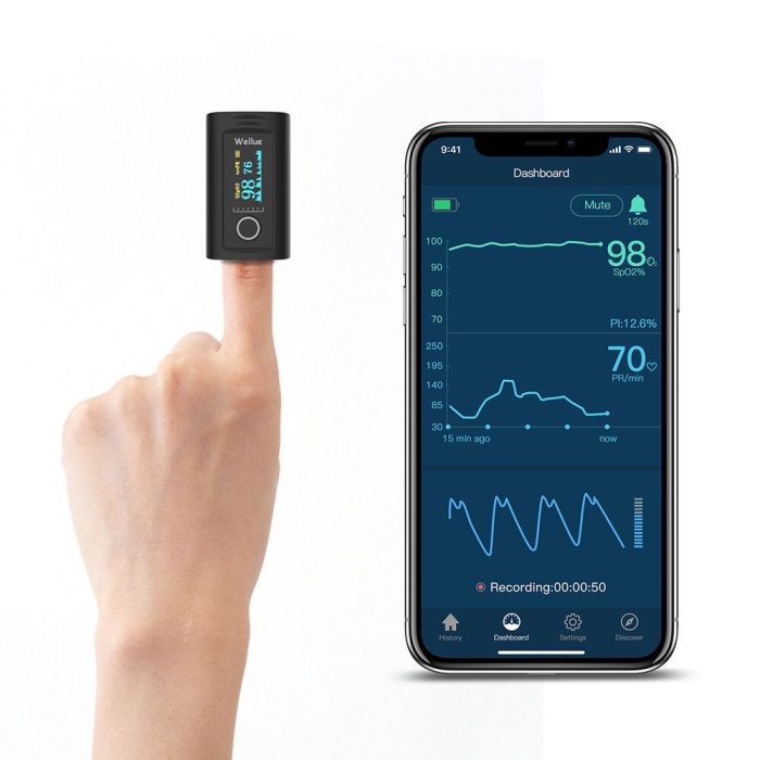 Viatom pulzoximéter Bluetooth kapcsolattal