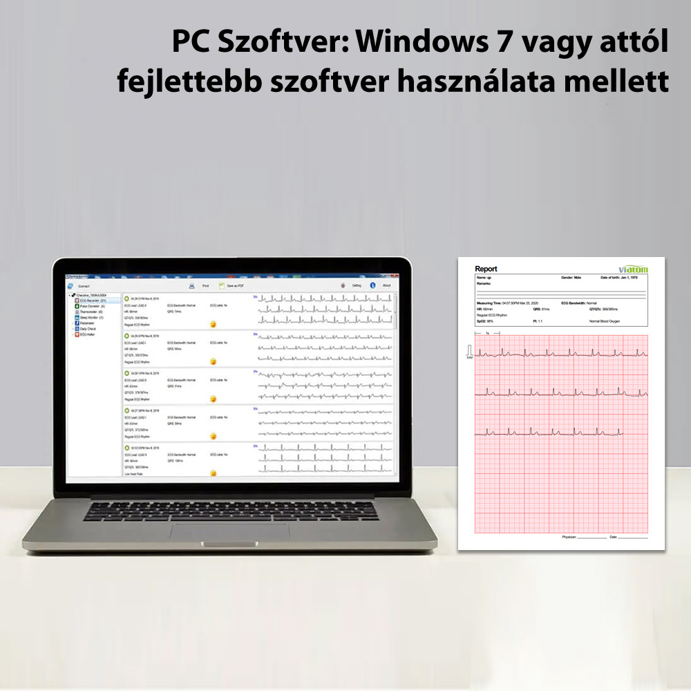 Checkme Pro öndiagnosztikai készülék - adattovábbítás