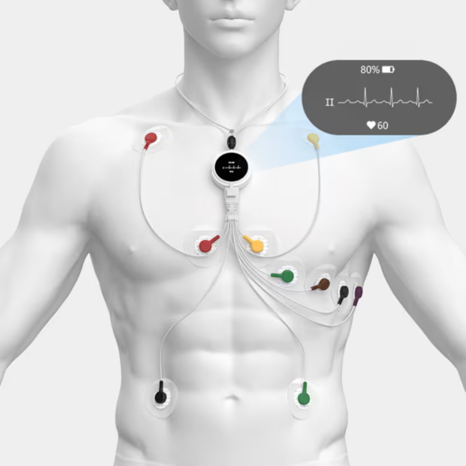 Viatom Lepod Pro ER3 12 elvezetéses 24 órás mini EKG holter monitor - Image 3