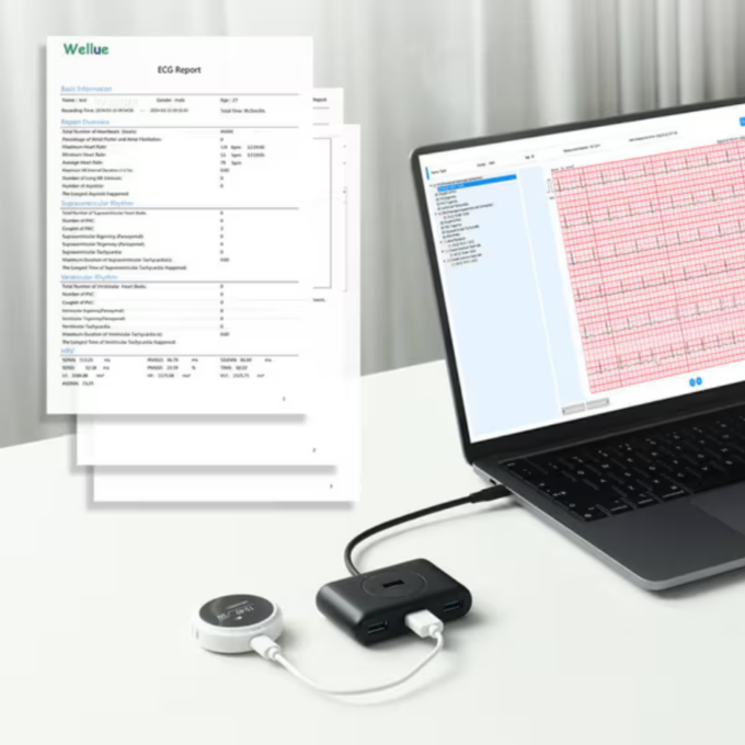 Viatom Lepod Pro ER3 12 elvezetéses 24 órás mini EKG holter monitor - Image 5
