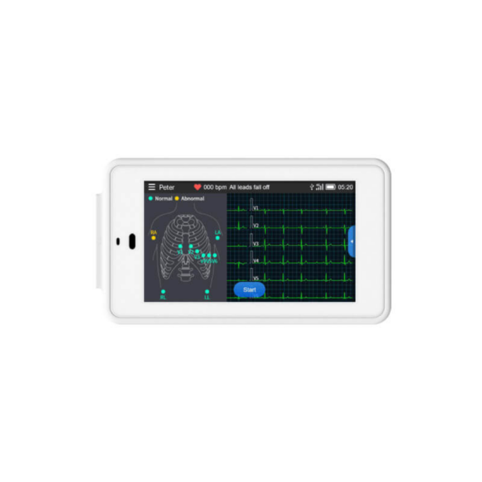 Viatom ECG 500 6/12 elvezetéses zseb-EKG készülék - Image 2